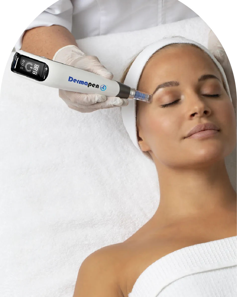 Микроигольчатая терапия Dermapen на лице