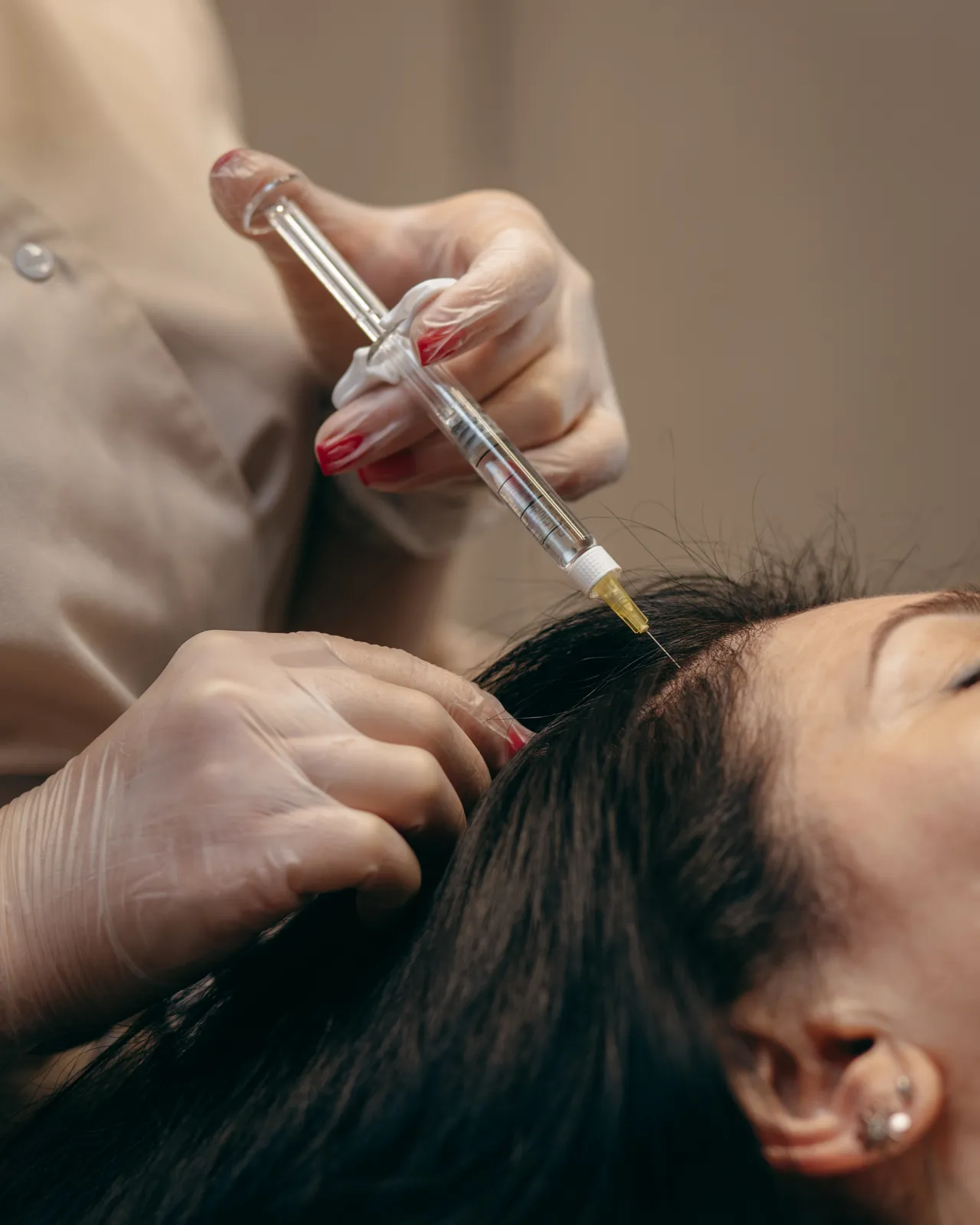 Scalp treatment with fine injections