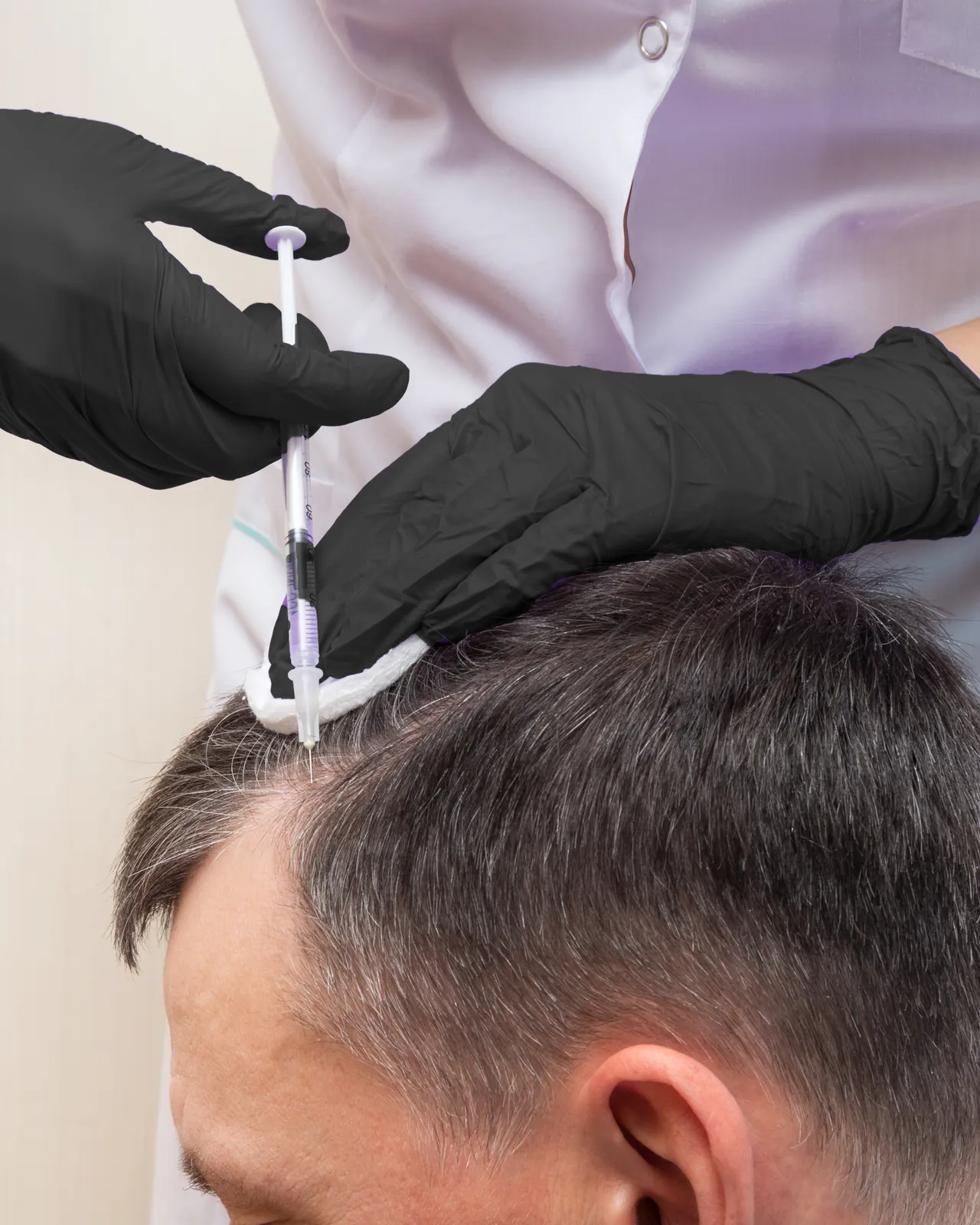 Injection treatment on a man’s scalp