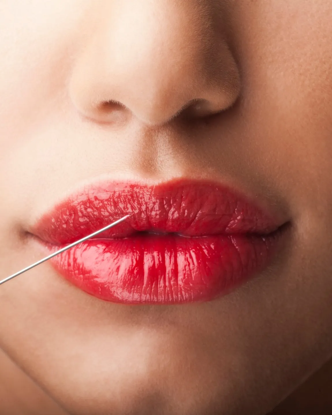 Close-up of lips with a fine injection needle